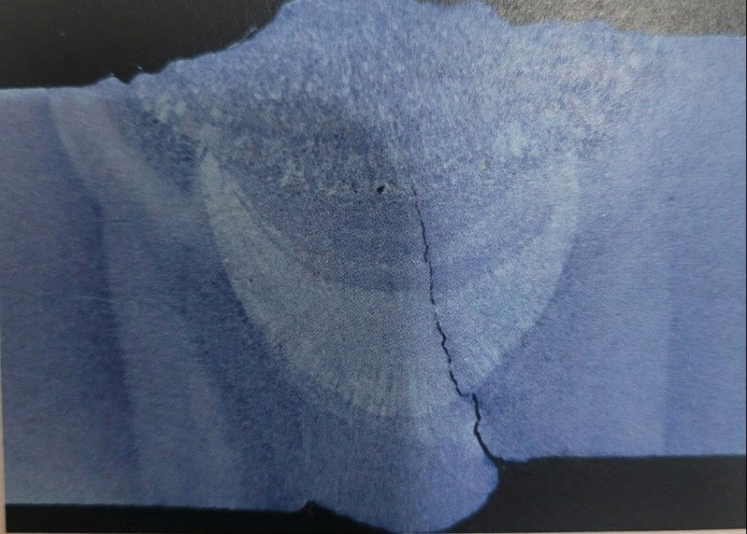 Prevention Strategies